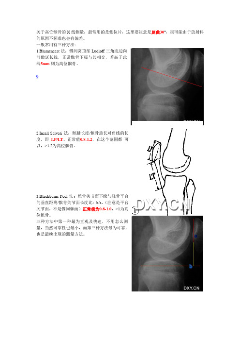 关于高位髌骨的X线测量及诊疗