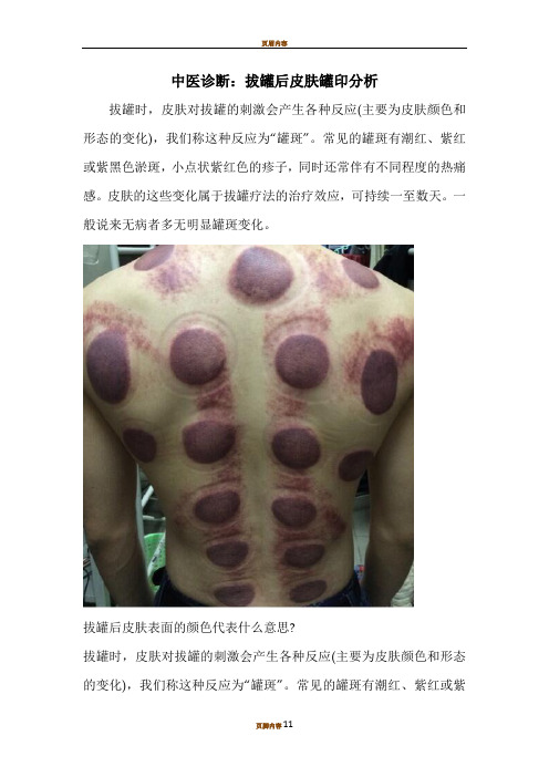 中医诊断：拔罐后皮肤罐印分析