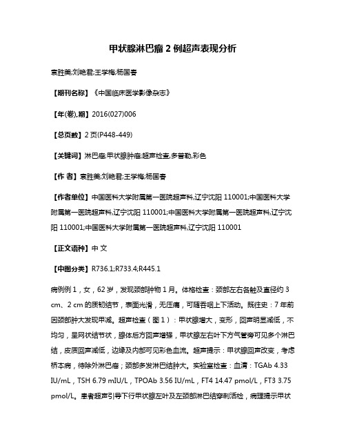 甲状腺淋巴瘤2例超声表现分析