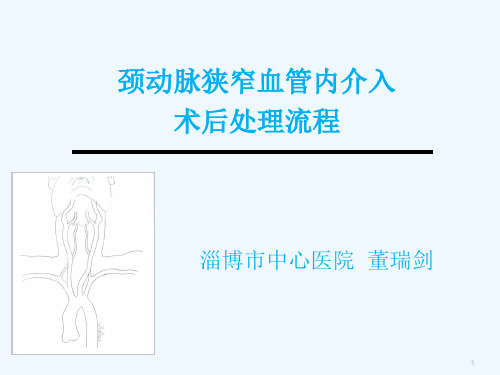 颈动脉支架术后流程