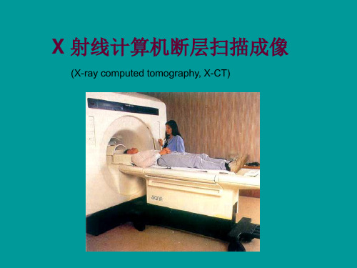 x-ct