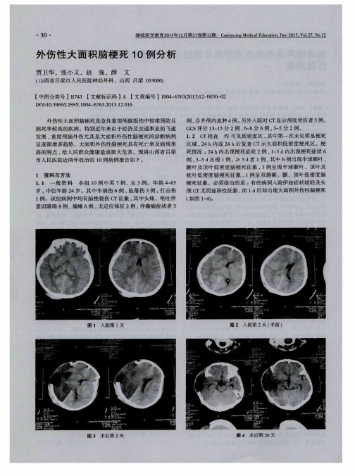 外伤性大面积脑梗死10例分析