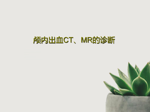 颅内出血CT、MR的诊断共161页