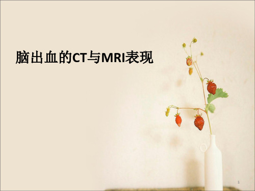 脑出血的影像学表现PPT参考幻灯片