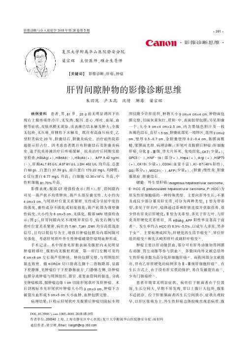 肝胃间隙肿物的影像诊断思维