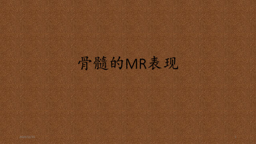 骨髓的MR表现 ppt课件