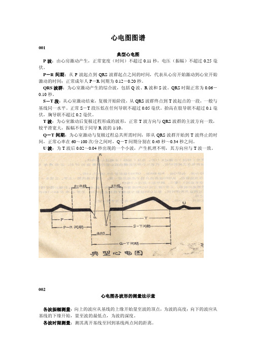 心电图图谱