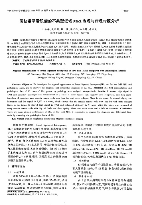 阔韧带平滑肌瘤的不典型低场MRI表现与病理对照分析