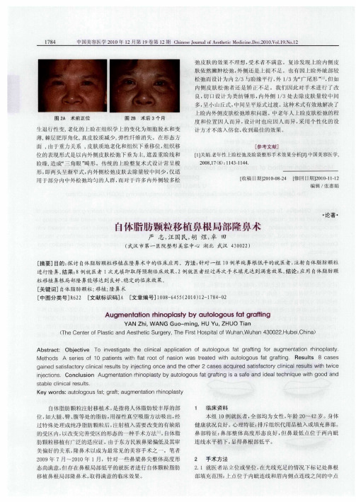 自体脂肪颗粒移植鼻根局部隆鼻术