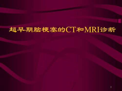 超早期脑梗塞的CT和MRI诊断医学PPT课件