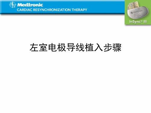 左室电极导线植入步骤-精品医学课件
