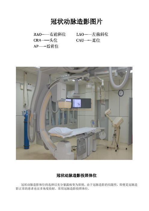 冠状动脉造影体位图片