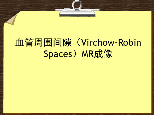 血管间腔(V-R space)的MRI表现资料