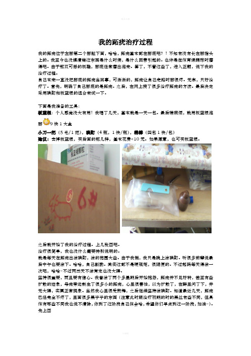 跖疣治疗过程记录