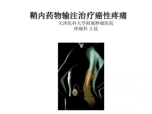 鞘内药物输注治疗癌性疼痛王昆课稿演示课件