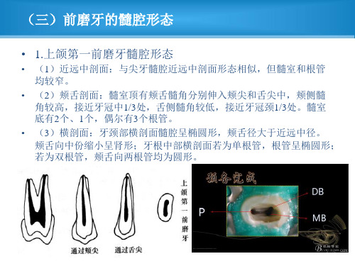 前磨牙及磨牙髓腔解剖