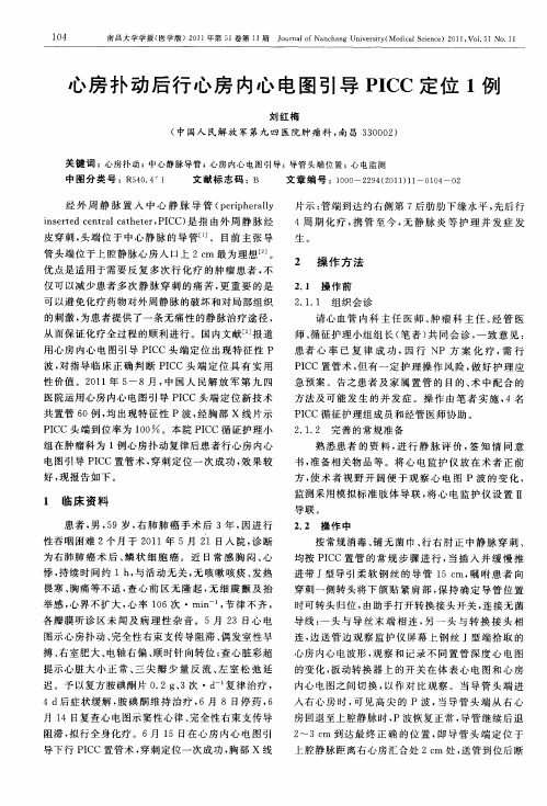 心房扑动后行心房内心电图引导PICC定位1例