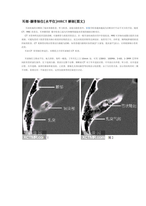 耳部CT解剖