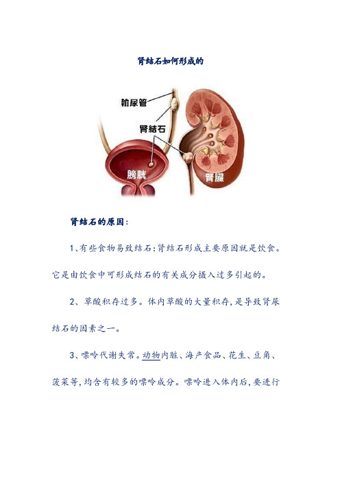 肾结石如何形成的