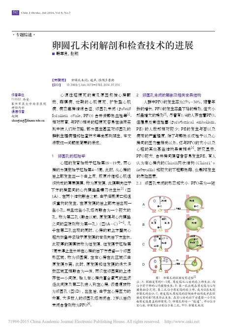 卵圆孔未闭解剖和检查技术的进展_韩军良