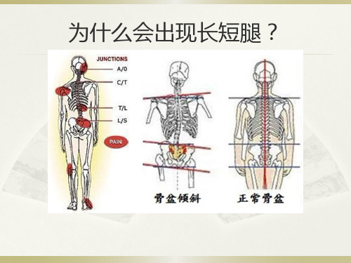 美式整脊