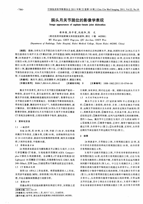 腕头月关节脱位的影像学表现