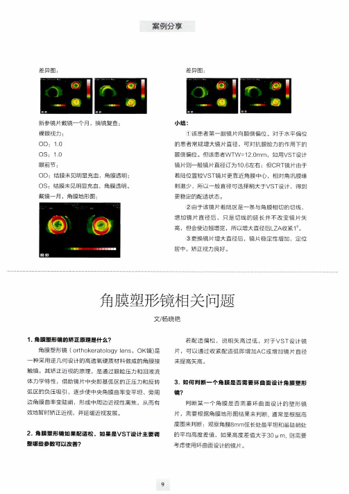 角膜塑形镜相关问题