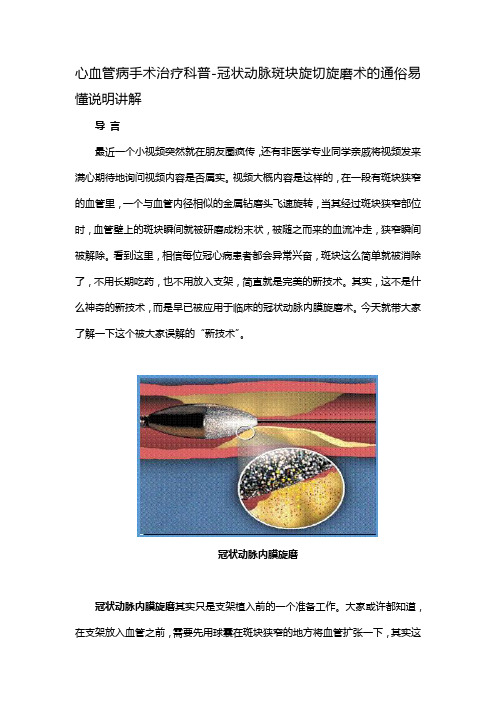 心血管病手术治疗科普-冠状动脉斑块旋切旋磨术的通俗易懂说明讲解