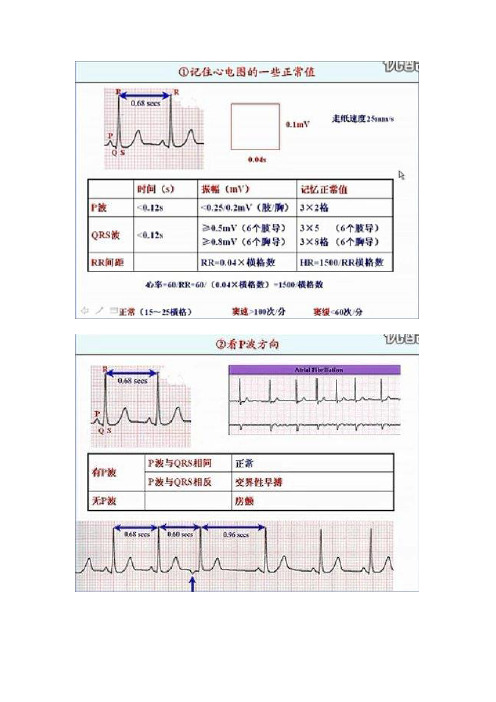 心电图讲课稿