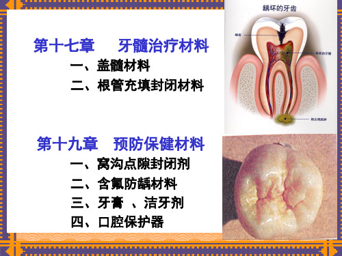 牙髓治疗材料