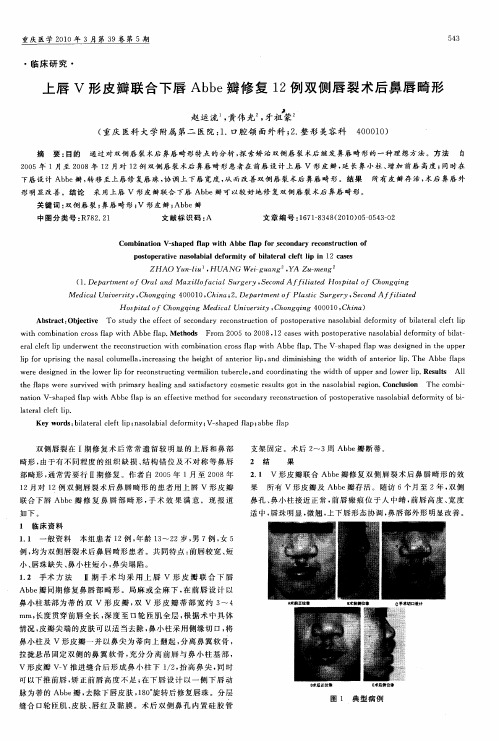 上唇V形皮瓣联合下唇Abbe瓣修复12例双侧唇裂术后鼻唇畸形