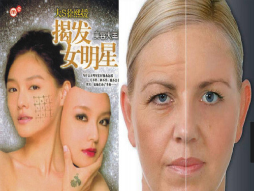 医学课件热玛吉培训资料