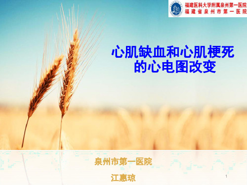(参考课件)心肌缺血与心肌梗死心电图改变