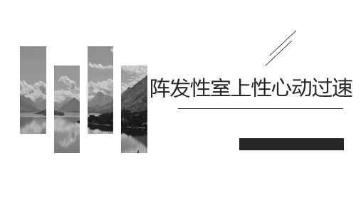 儿童阵发性室上性心动过速.pptx