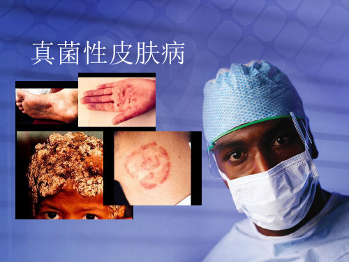 皮肤病学：真菌性皮肤病