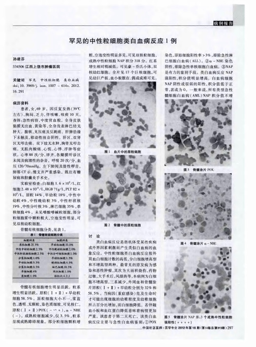 罕见的中性粒细胞类白血病反应1例