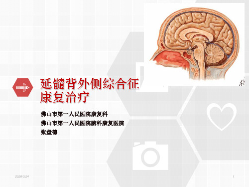延髓背外侧综合征的康复治疗PPT参考幻灯片