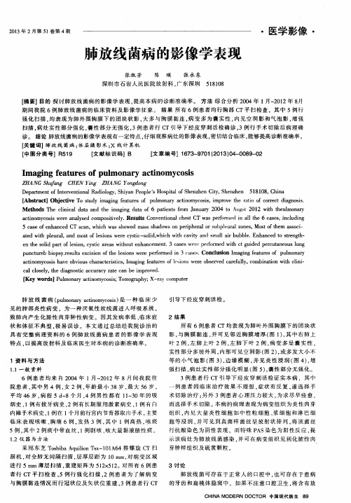 肺放线菌病的影像学表现