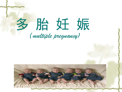 多胎妊娠 吉林大学五年制妇产科课件