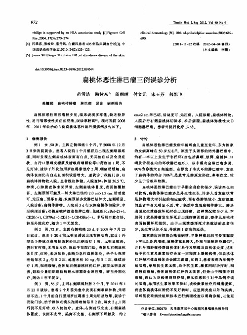 扁桃体恶性淋巴瘤三例误诊分析