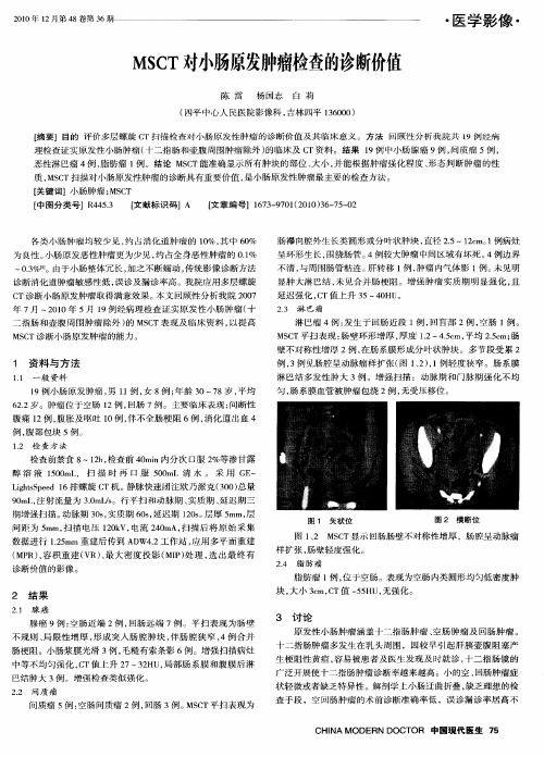 MSCT对小肠原发肿瘤检查的诊断价值