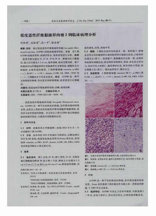 低度恶性纤维黏液样肉瘤2例临床病理分析