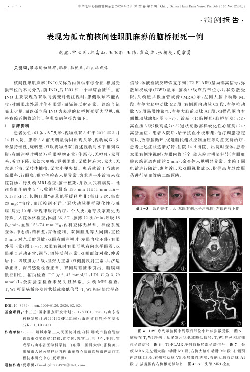 表现为孤立前核间性眼肌麻痹的脑桥梗死一例