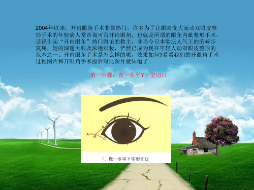 开内眼角手术过程图及开内眼角效果对比图