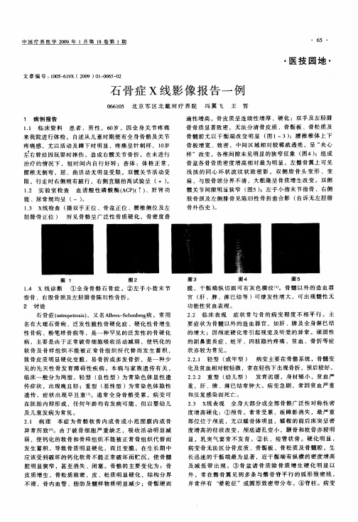 石骨症X线影像报告一例