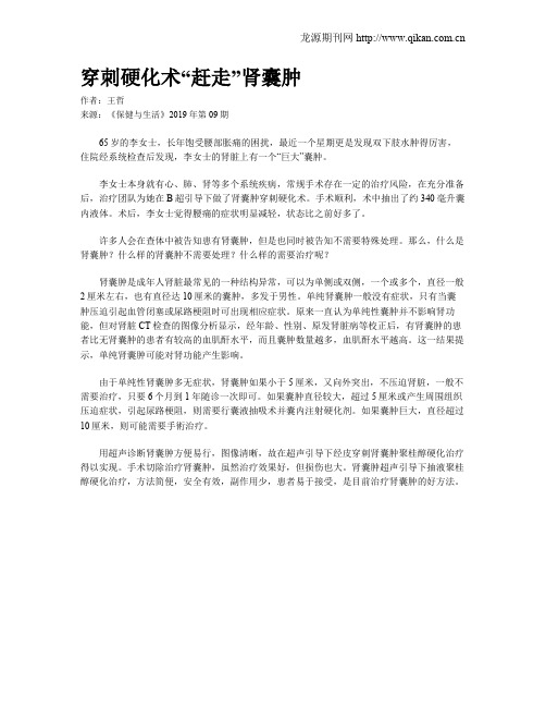 穿刺硬化术“赶走”肾囊肿