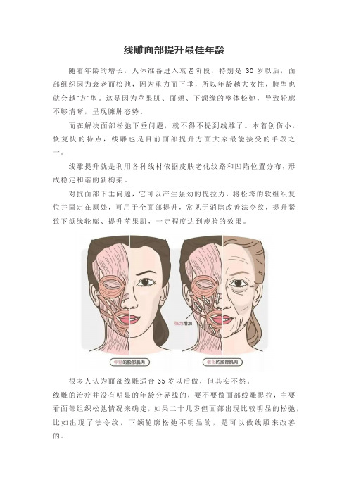 线雕面部提升知识科普
