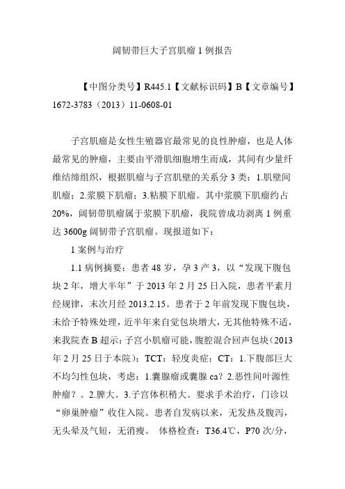 阔韧带巨大子宫肌瘤1例报告