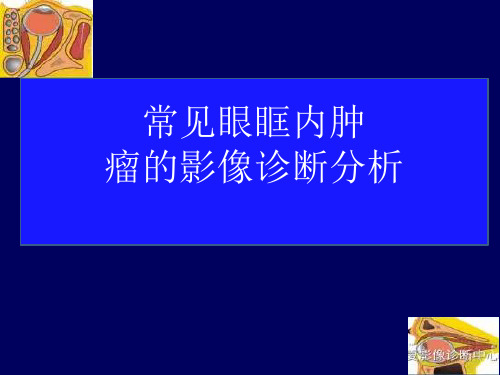 常见眼眶内肿瘤的影像诊断分析