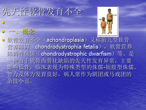 先天性软骨发育不良
